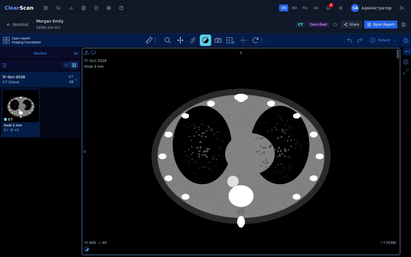 ClearScan study viewer (demo data)