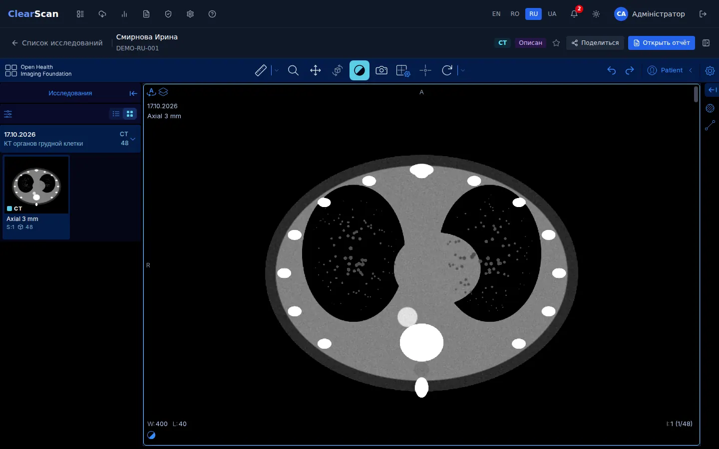Просмотрщик исследований ClearScan (демонстрационные данные)
