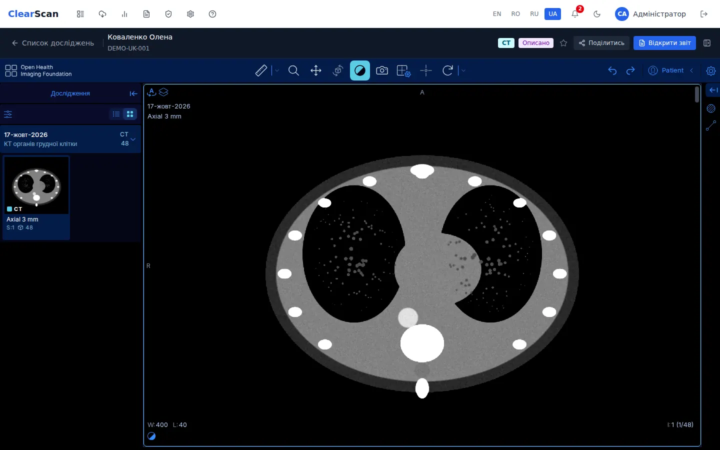 Переглядач досліджень ClearScan (демонстраційні дані)